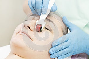 Woman undergoes the procedure of medical micro needle therapy with a modern medical instrument derma roller.