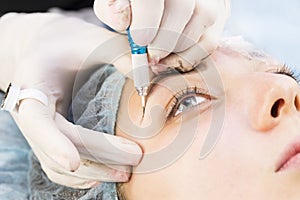 Medical micro needle therapy with a modern medical instrument derma roller. photo