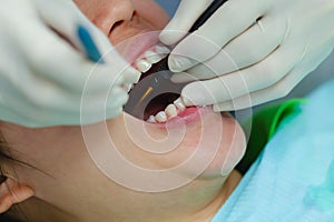 Woman is undergoing dental treatment and specialist is doing check up and curing teeth patient