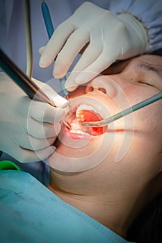 Woman is undergoing dental treatment and specialist is doing check up and curing teeth patient