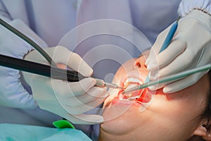 Woman is undergoing dental treatment and specialist is doing check up and curing teeth patient