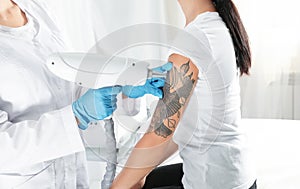 Woman undergoing laser tattoo removal procedure