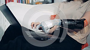 A woman uses robotic hand to type on a laptop, close up.