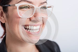 A woman uses transparent retainers to whiten teeth photo