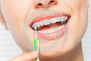 Woman using brush for orthodontic braces