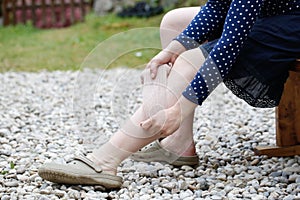 Woman with varicose veins applying compression bandage