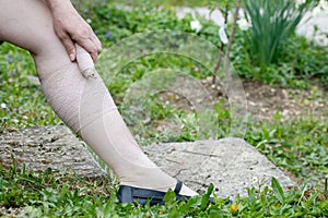 Woman with varicose veins applying compression bandage