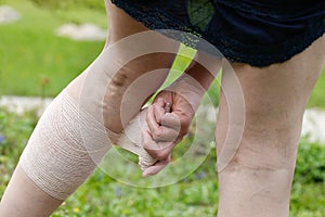 Woman with varicose veins applying compression bandage