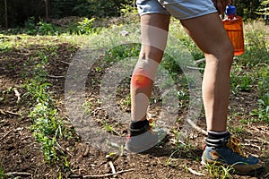 Woman with varicose veins on a hiking trip with red dot effect