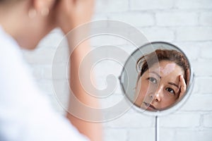 A woman with vitiligo looks in the mirror. Reflection in a table mirror a girl with a white spot on her forehead