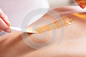 Woman Waxing Man`s Chest With Wax Strip