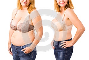 Woman before and after weight loss photo