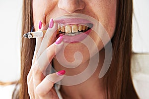 Woman with yellow dirty teeth