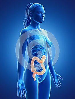 A womans colon