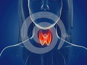 A womans thyroid gland