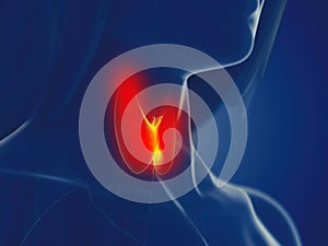 A womans thyroid gland