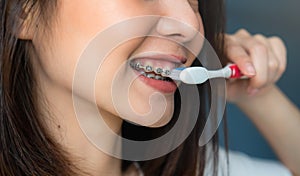 Women are brushing teeth that wear braces, in a toilet. Must maintain good oral health. photo