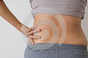 Women fat belly fat with stretch marks