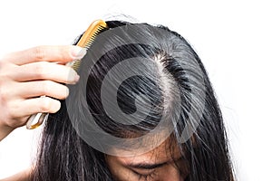 Women head with dandruff Caused by the problem of dirty. Or caused by skin disease or Seborrheic Dermatitis. It has white scaly an