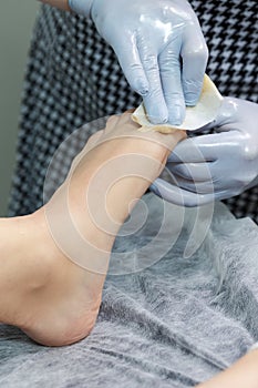 Women Healthcare Concept. Beautician Doing Depilation With Hot Wax On Woman`s Toe Using Liquid Wax In Spa