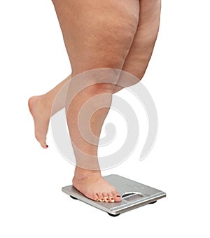 Women legs with overweight