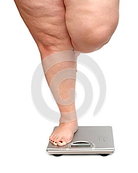 Women legs with overweight