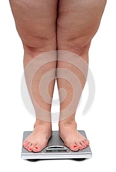 Women legs with overweight photo