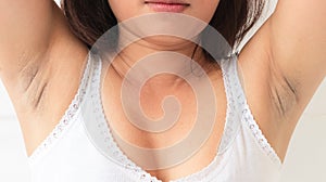 Women problem black armpit on white background for skin care and photo