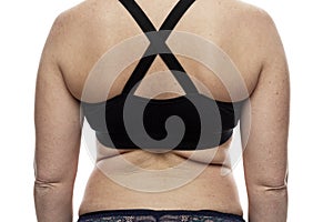 Women`s back with folds of fat. Obesity and overweight. White background. Close-up