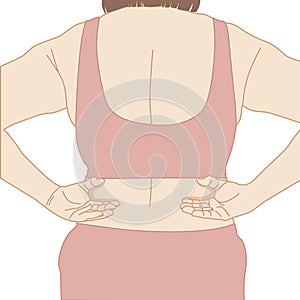 Women`s backs are overweight with fat cellulite deposits on the body in red underwear on white background