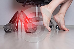 Women`s legs in the office hanging from the office chair that itch due to a fungal infection contagious shoes copy space medicinal