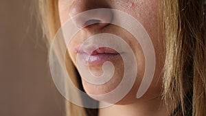 Women`s lip ulcers herpes closeup. Beautiful lips were covered with cold sores. The girl licks her lips covered with