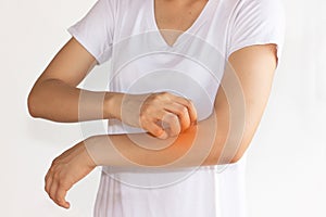 Women scratch itchy arm with hand