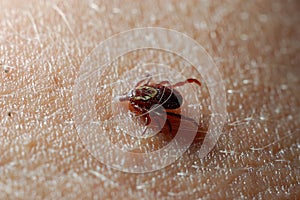 Wood Tick
