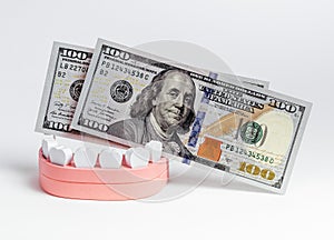Wooden jaw model with US dollar bills. Financial expenses for teeth treatment and implantation concept.