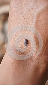 woodlice crawling onto human hands