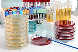 Workbench with biological samples on the microbiology laboratory