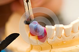 Working dental technician