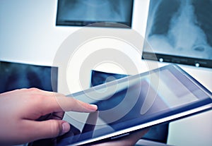Working with digital tablet in radiology