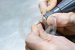 Working with a drill in a dental prosthesis