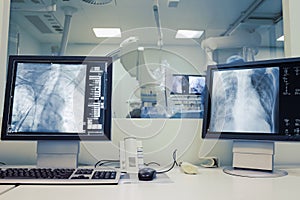 Working with patient in cathlab