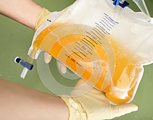 Working with urometr in hospital