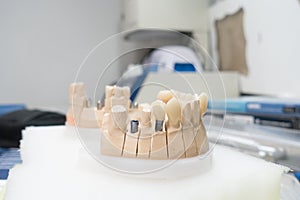 Workplace of a dental technician for the manufacture of dental prostheses