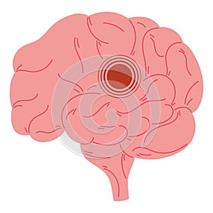 world parkinson day brain condition