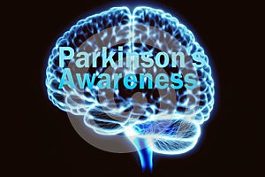 World Parkinson\'s Disease Day is celebrated each year on April 11