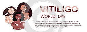 World vitiligo day background template vector illustration