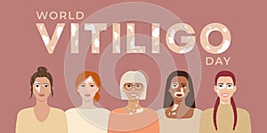 World vitiligo day June 25 banner. Female faces with different ethnics, skin colors, hairstyles with vitiligo skin disease. Body