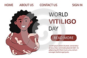 World vitiligo day landing page template vector illustration