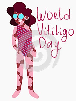 World vitiligo day smiling girl isolated on white stock vector illustration.