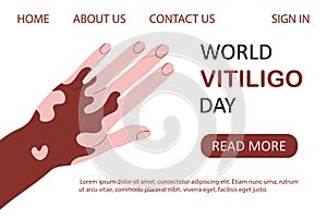 World vitiligo day web template vector illustration